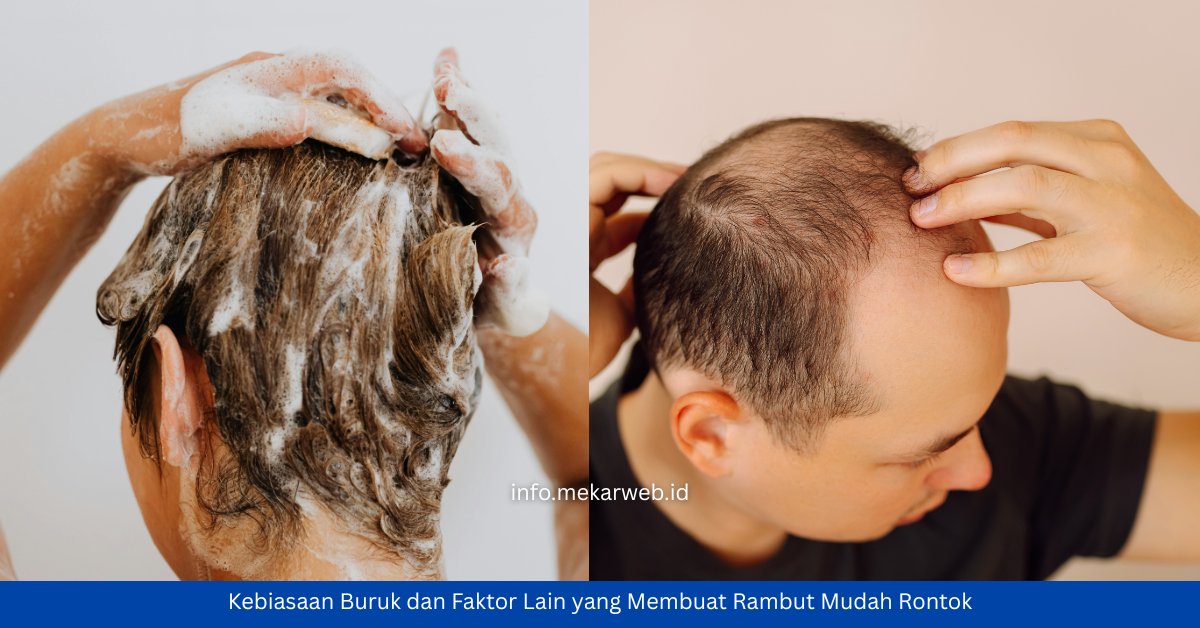 Kebiasaan Buruk dan Faktor yang Membuat Rambut Mudah Rontok